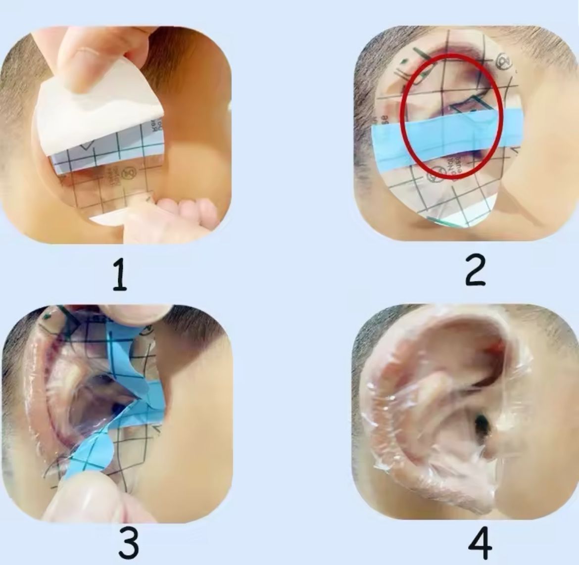 Protection Complète pour les Oreilles de Bébé (20 Pièces)